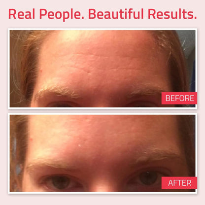 Yeouth 2.5% Retinol Serum 2oz