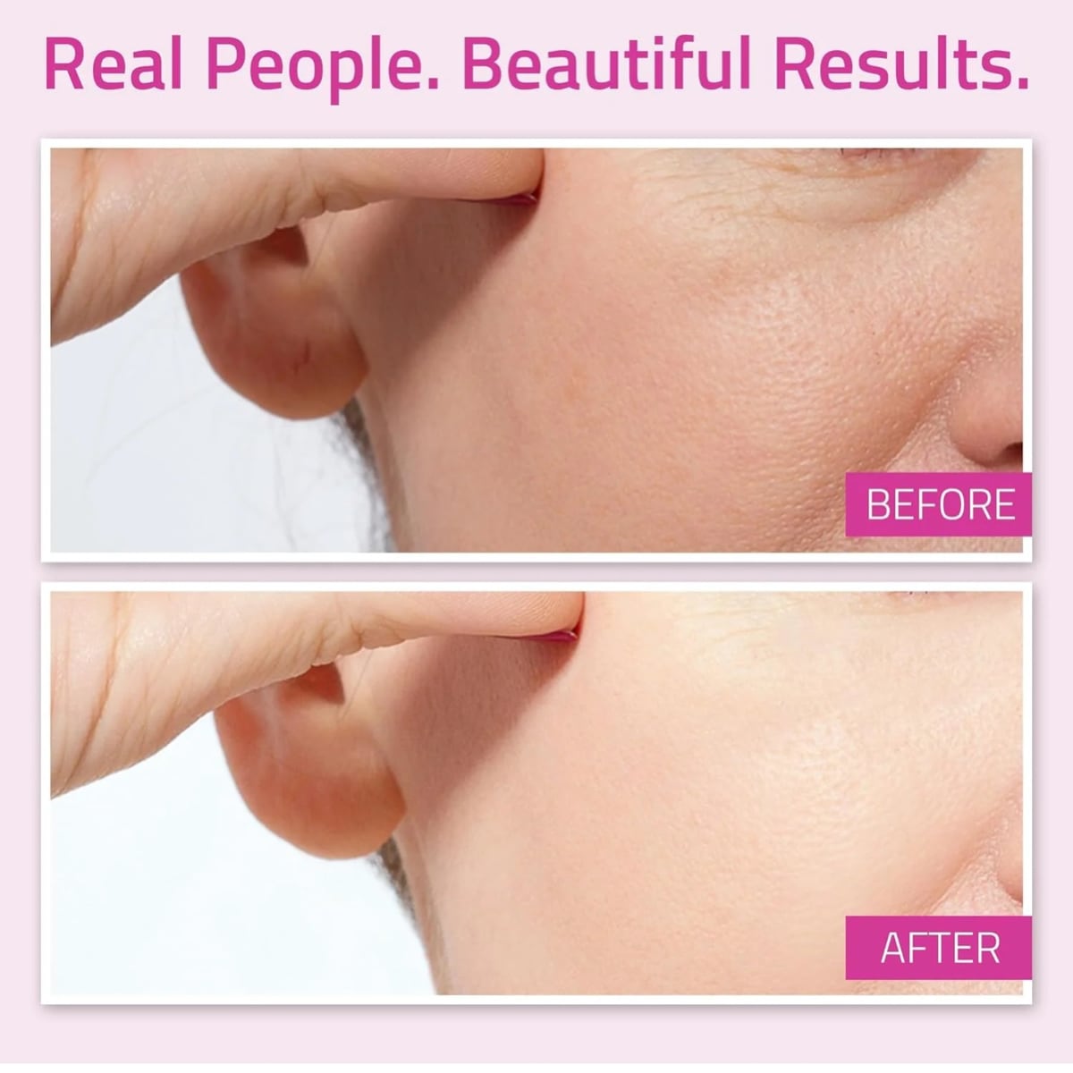 Yeouth L22 Anti-Aging Moisturizer 1oz 1oz