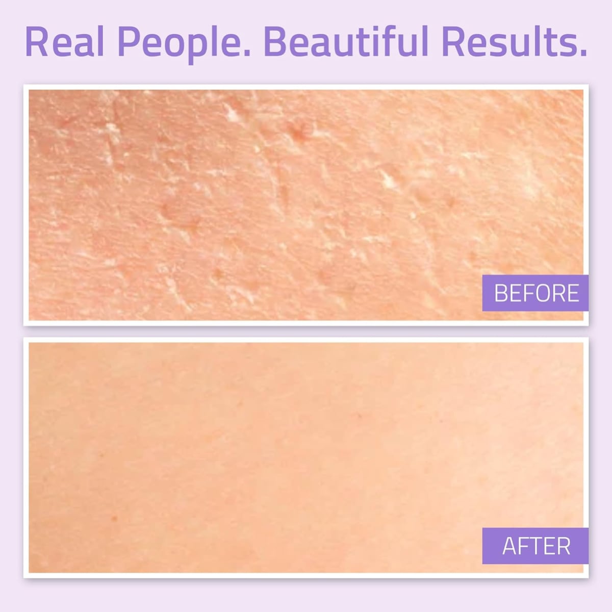 Yeouth Hyaluronic Acid Cream 1oz 1oz