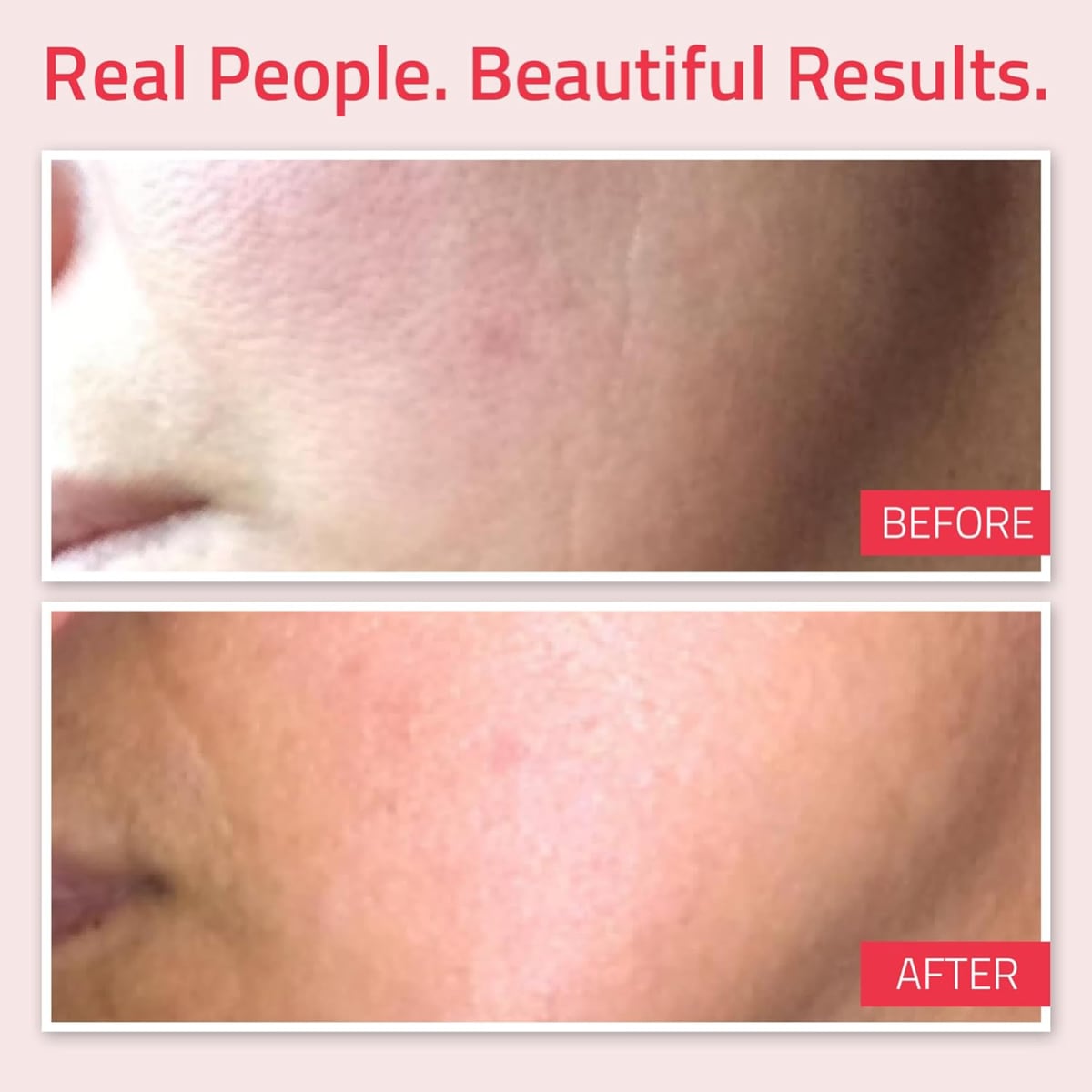 Yeouth Retinol Moisturizer Cream 2oz