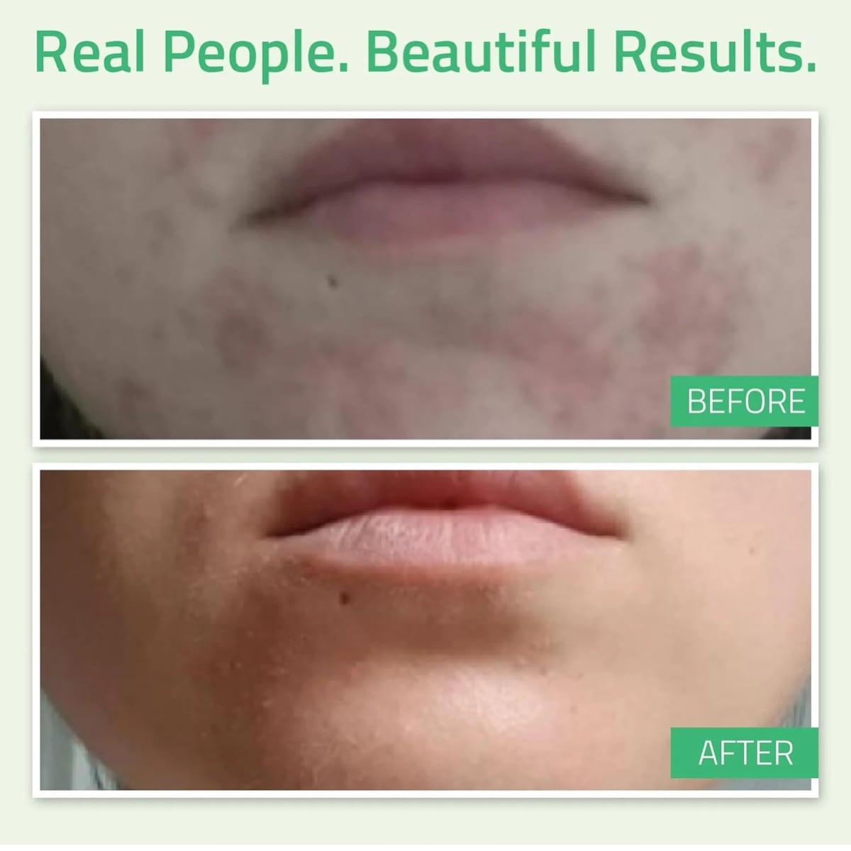 Yeouth 30% Glycolic Acid Gel Peel 1oz