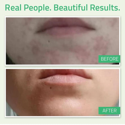 Yeouth 30% Glycolic Acid Gel Peel 2oz